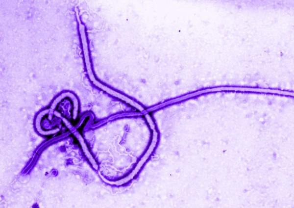 cdc patent on ebola