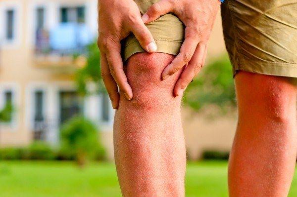 Prolotherapy to treat knee arthritis
