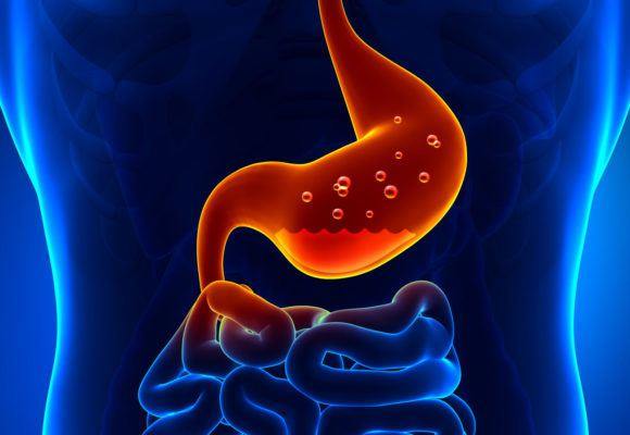 Measuring your stomach acid production