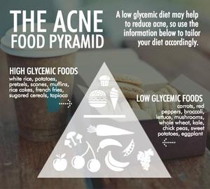 Acne Food pyramid